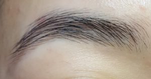 Brow