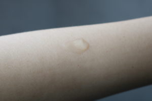 Ascorbyl Glucoside Solution 12%